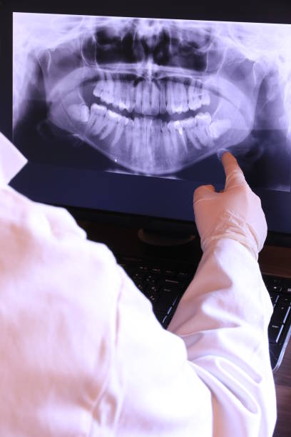 Dentist for Dental Trauma in NY
