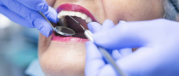 Best Chipped Tooth Repair Near Me  in South Valley Stream, NY